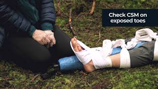 Upper Leg Splint  Fundamentals of Wilderness First Aid [upl. by Evan416]