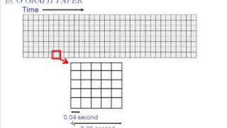 ECG Graph Paper [upl. by Kempe]