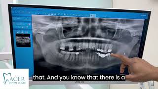 Understanding Panoramic XRays A Complete Dental Guide [upl. by Chapin]