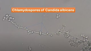 Chlamydospores of Candida albicans observation [upl. by Ahtoelc]