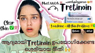 ‼️🔥Clear Skin വേണോ ⁉️😵‍💫⚠️മുഖക്കുരുകറുത്തപാടുകൾകുഴികൾ✅ How To Use Tretinoin⁉️ BEING US BY AJ [upl. by Llekram760]