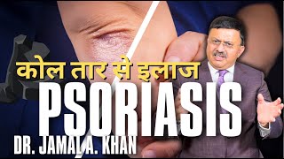 Psoriasis Causes Triggers and Treatments  Dr Jamal A Khan [upl. by Krever]