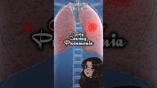 CavityCausing Pneumonia causativeorganisms shorts medicalshorts [upl. by Malarkey]