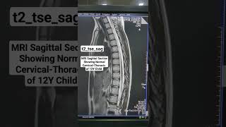 Difference Between Sagittal and Midsagittal [upl. by Attem943]