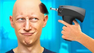 Top 5 NEW Hair Restoration Treatments YOU Need To Know About [upl. by Suckow]