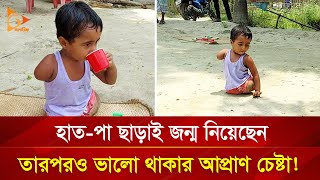 অবুঝ শিশুটির ভালো থাকার আপ্রাণ চেষ্টা  Nagorik TV Special [upl. by Nariko]