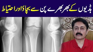 Osteoporosis causes and precautions  Dr Faisal Syed [upl. by Maren567]