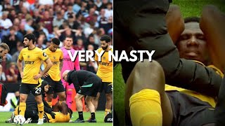 Wolves Defender Yerson Mosquera nasty Injury Vs Aston Villa [upl. by Sivla931]