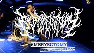 EMBRYECTOMY Beatdown Guttural Slam UNDEGROUND METAL TV [upl. by Zannini]