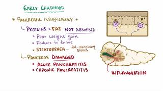 Cystic fibrosis causes symptoms diagnosis treatment amp pathology [upl. by Leonard]