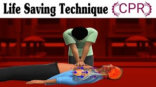 CPR Procedure Step by Step in Nursing [upl. by Adnaw]