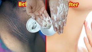 গলার কালো দাগ দূর করার উপায়  Neck Black Remove Beauty Tips [upl. by Odericus]