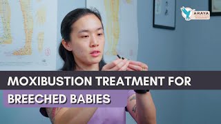 Moxibustion for Breeched Babies  with Dr Khanita [upl. by Florin885]