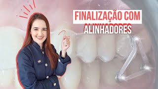 Finalização com Alinhadores refinamento alinhadores adicionais ou mecânica de intercuspidação [upl. by Amehsat98]