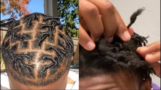 My Starter Locs Are BUDDING in 2 weeks 😱  Dreadloc Journey [upl. by Idell558]