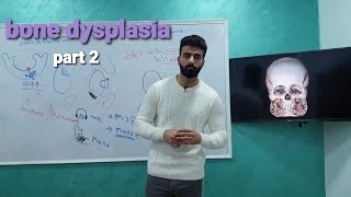 bone dysplasia 2 quot fibro osseous lesions quot  oral pathology  عزت شومان [upl. by Manya]