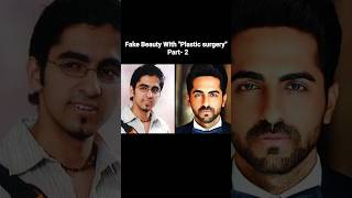 Fake beauty with plastic surgery  plastic surgery face  plasticsurgery bollywood [upl. by Ly]