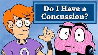 Do I Have a Concussion [upl. by Stegman]