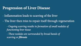 Liver Disease  Fibrosis [upl. by Nahtahoj]