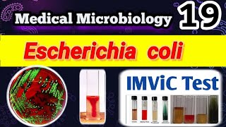 Escherichia coli part 2 شرح الشغل العملي بالعربي Identification and Laboratory diagnosis [upl. by Byran]