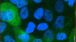 Mitotic catastrophe triggered in human cancer cells by the viral protein apoptin  movie A [upl. by Wiskind]