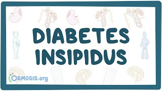 Diabetes insipidus  causes symptoms diagnosis treatment pathology [upl. by Anella]