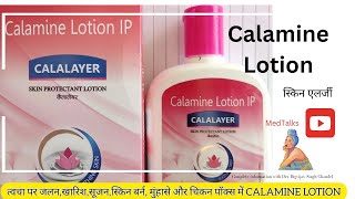 calamine lotion uses detail information Hindi MedTalks777 [upl. by Ibloc870]