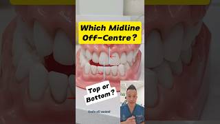 Is Your Top or Bottom Dental Midline OffCenter How to Tell dentallan dentist shorts [upl. by Natanoj229]