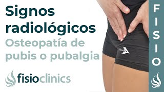 Osteopatía de pubis o pubalgia Signos radiológicos  FisioClinics Palma de Mallorca [upl. by Aletsirc]