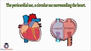 Cardiac Tamponade Pulsus Paradoxus [upl. by Kcorb871]