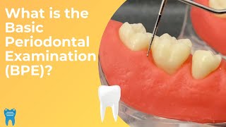 Basic Periodontal Examination BPE  What Why and How [upl. by Barolet]