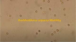 Burkholderia cepacia Motility [upl. by Brenza]