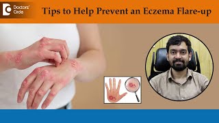 What Causes Eczema to Flare Up  How to Treat amp Get Rid of EczemaDrRajdeep Mysore Doctors Circle [upl. by Lisab]