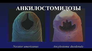 Анкилостомидозы Анкилостомоз Ancylostoma duodenale и Некатороз Necator americanus [upl. by Jennine]