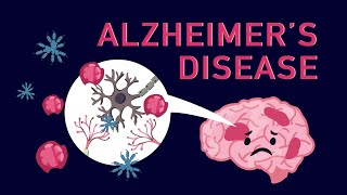 What is Alzheimer’s Disease [upl. by Herstein]