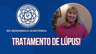 Bio Ressonância Quantiônica Tratamento De Lúpus Dárcio Cavallini [upl. by Sokairyk923]