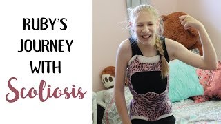 Rubys Scoliosis Journey 💕 Tips and Tricks for Brace [upl. by Solracesoj]