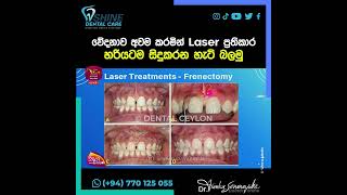 වේදනාව අවම කරමින් Laser ප්‍රතිකාර හරියටම සිදුකරන හැටි බලමු [upl. by Nessy]