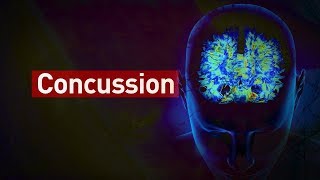 How do concussions affect the brain [upl. by Yrak]