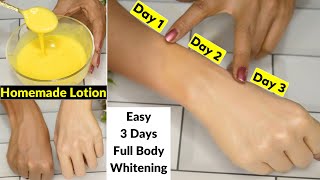 I applied👆this Skin Whitening Lotion On Dark HandsIn 3 Days Dark Dull Skin Got Fair White amp Glowing [upl. by Nyleimaj]