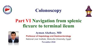 Colonoscopy Part VI Navigation of the splenic flexure to TI 2024 [upl. by Atnoid]