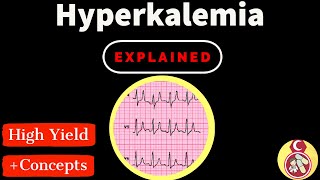 Hyperkalemia  Causes  signs  management شرح بالعربي [upl. by Epifano]