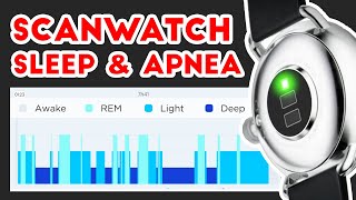 Withings Scanwatch Sleep Tracking amp Sleep Apnea Interview w withings Pt 2 [upl. by Ankeny]