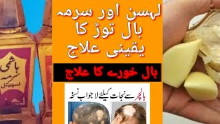 sukoontv  balchar ka ilaj  alopecia Areta treatment  balchara part 02 [upl. by Woodrow940]