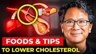 Dr William Lis SHOCKING Tips to Lower Cholesterol Foods You Need to Know [upl. by Nytsua]