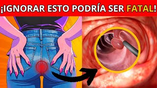 Cáncer de intestino ¡las señales silenciosas que están matando a la gente [upl. by Herm]