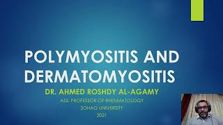 8 PolymyositisDermatomyositis PMDM [upl. by Kendra]