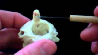 Vertebral Column Bone VideoMP4 [upl. by Ludwigg]