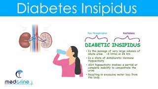 Diabetes Insipidus DI Causes Symptoms Diagnosis and treatment [upl. by Nabatse981]