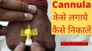 Cannula Kaise Lagate Hain  Kaise Nikale  Cannula Insertion Technique  Cannula Types  Hindi [upl. by Rollin534]